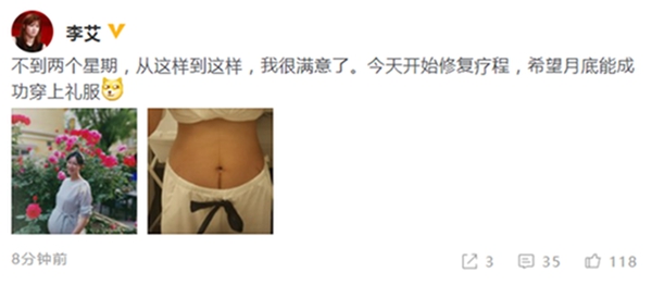 李艾产后首晒肚皮照 网友希望她能出减肥教程